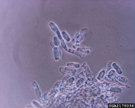 2175036