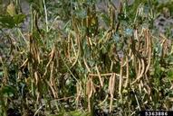5363886