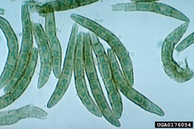brown spot needle blight of pine (Mycosphaerella dearnessii ) on Caribbean pine (Pinus caribea ) - 0176054