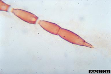 onion thrips, Thrips tabaci  (Thysanoptera: Thripidae) - 0177011
