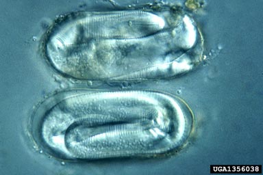 yellow potato cyst nematode, Globodera rostochiensis  (Tylenchida: Heteroderidae) - 1356038