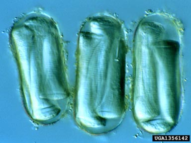 yellow potato cyst nematode, Globodera rostochiensis  (Tylenchida: Heteroderidae) - 1356142