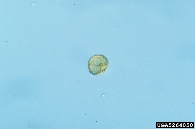 daylily rust, Puccinia hemerocallidis  (Uredinales: Pucciniaceae) - 5264050