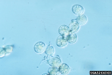 daylily rust, Puccinia hemerocallidis  (Uredinales: Pucciniaceae) - 5264060