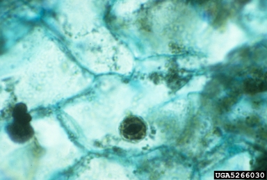 Tobacco Etch Virus, Potyvirus TEV  (Unassigned single stranded positive-sense RNA viruses: Potyviridae) - 5266030