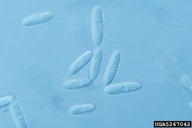 anthracnose, Colletotrichum spp.  (Phyllachorales: Phyllachoraceae) - 5267042