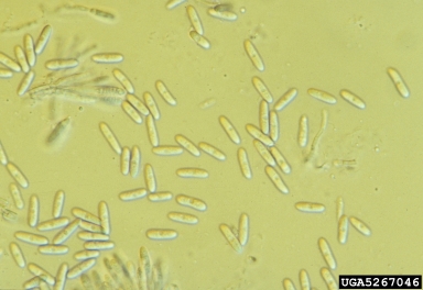 anthracnose, Colletotrichum spp.  (Phyllachorales: Phyllachoraceae) - 5267046