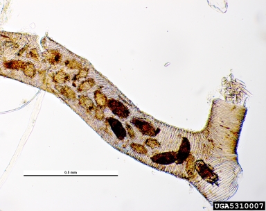honey bee mite, Acarapis woodi  (Acari: Tarsonemidae) - 5310007