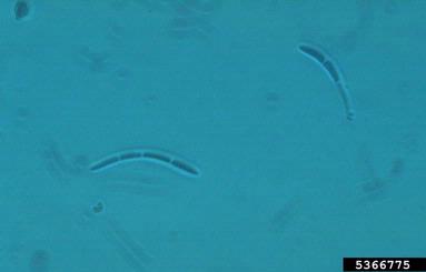 Mycosphaerella fungi, Mycosphaerella spp.  (Capnodiales: Mycosphaerellaceae) - 5366775