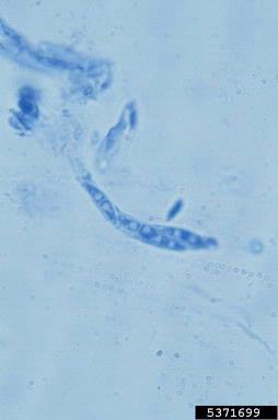 Kutilakesa fungus, Kutilakesa madreeya  (Incertae sedis: Incertae sedis) - 5371699
