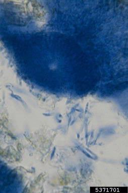 Kutilakesa fungus, Kutilakesa madreeya  (Incertae sedis: Incertae sedis) - 5371701