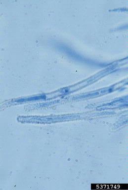 Kutilakesa fungus, Kutilakesa pironii  (Incertae sedis: Incertae sedis) - 5371749