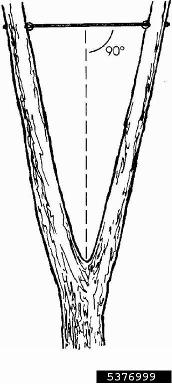 cabling,    - 5376999