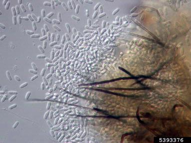 bean anthracnose, Colletotrichum lindemuthianum  (Phyllachorales: Phyllachoraceae) - 5393376