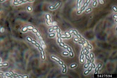 Thousand Cankers Disease (Geosmithia morbida ) on Potato dextrose agar (Fungal Non-selective Media PDA ) - 5427594