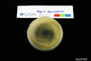 Botryosphaeria rots and cankers (Botryosphaeria spp. ) on Quarter strength potato dextrose agar (Fungal Non-selective Media QPDA ) - 5429783