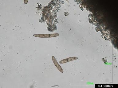 dry rot of ears and stalks of maize (Stenocarpella macrospora ) on corn (Zea mays ) - 5430069