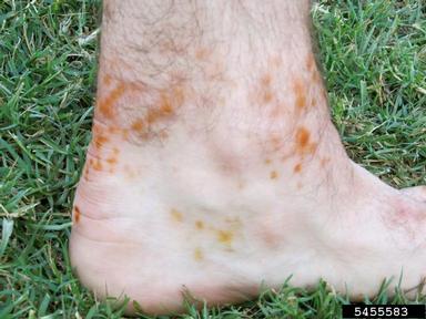 kudzu bug (Megacopta cribraria ) on human (Homo sapiens ) - 5455583