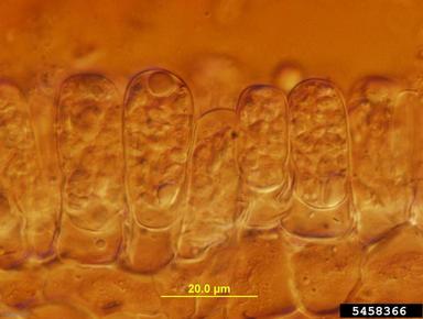 leaf blister (Taphrina spp. ) on red maple (Acer rubrum ) - 5458366