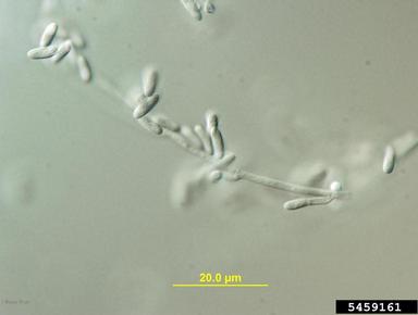 Tubercularia cankers (Tubercularia spp. ) on winged burning bush (Euonymus alatus ) - 5459161