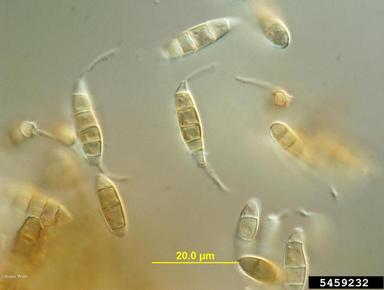 Seimatosporium fungi (Seimatosporium spp. ) on witch-hazel (Hamamelis spp. ) - 5459232