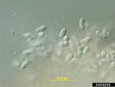 Ascochyta fungi (Ascochyta spp. ) on hickory (Carya spp. ) - 5459258