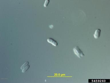 Ascochyta fungi (Ascochyta spp. ) on hickory (Carya spp. ) - 5459260