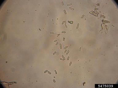 Ascochyta blight (Ascochyta lentis ) on lentil (Lens culinaris ) - 5475039