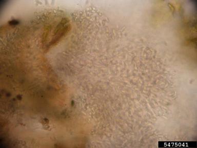 Ascochyta blight (Ascochyta lentis ) on lentil (Lens culinaris ) - 5475041