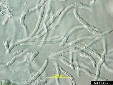 Septoria leaf spot (Septoria betulae ) on paper birch (Betula papyrifera ) - 5476482