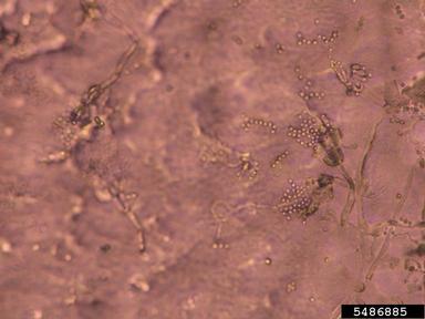 Penicillium fungi (Penicillium spp. ) on corn (Zea mays ) - 5486885