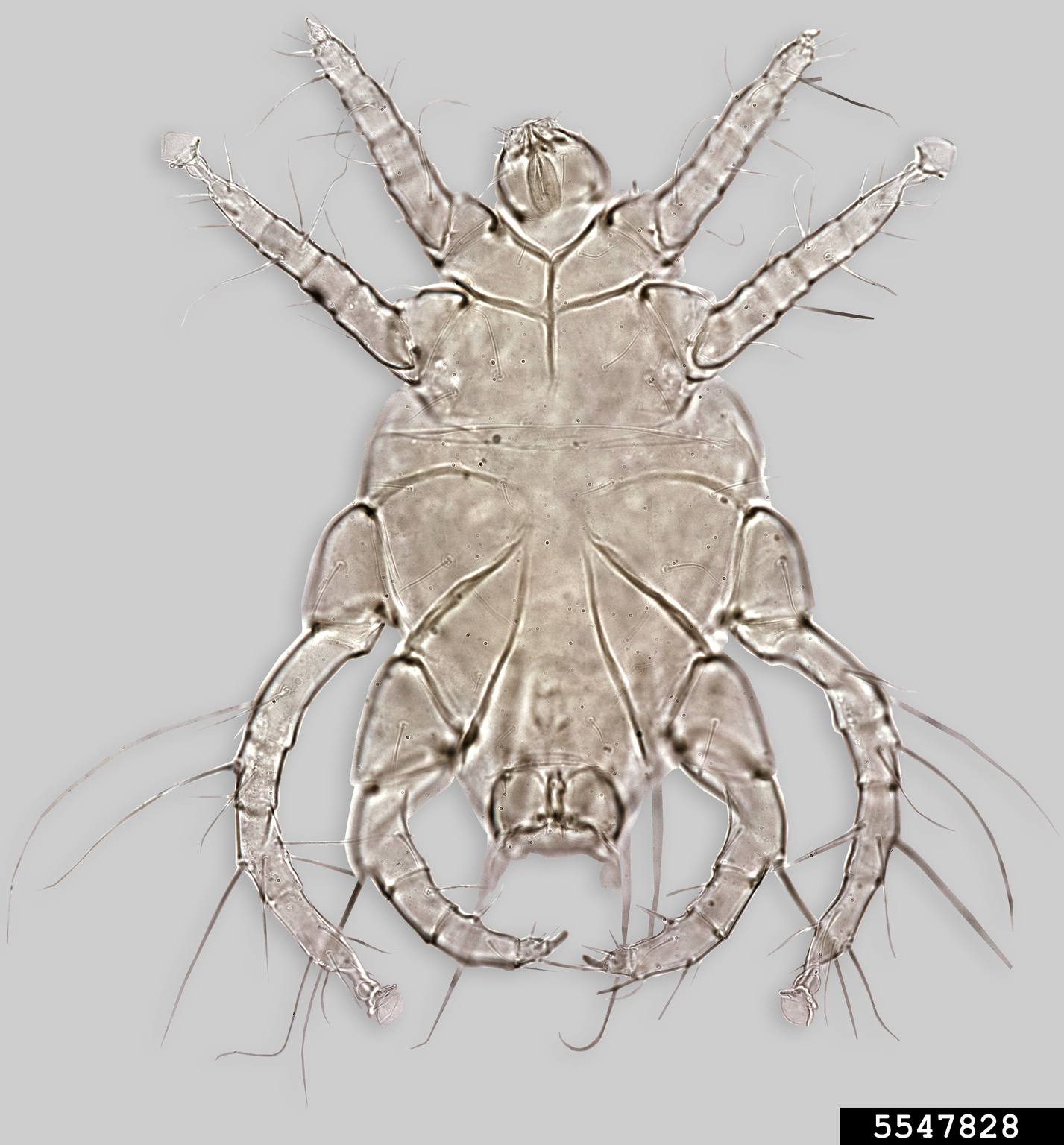 itch mites (Genus Pyemotes)