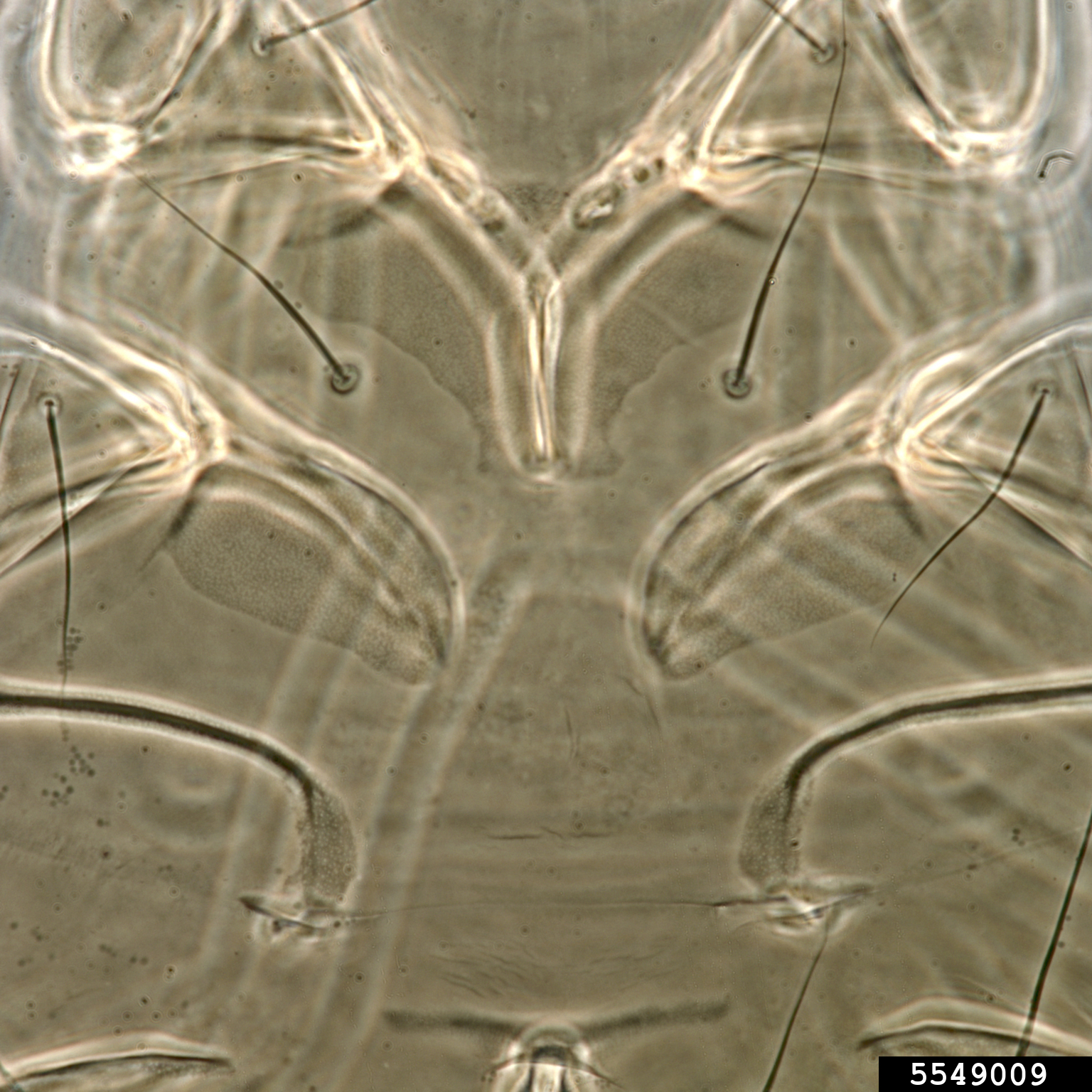 mold mite (Tyrophagus putrescentiae)