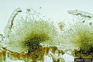 Dothistroma needle blight (<em>Mycosphaerella pini</em>) acervulus (transverse section); note hyaline mass.