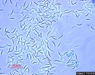 anthracnose (<em>Colletotrichum truncatum</em>) asexual spore