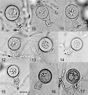 Mycol.Res 109, 853-859; Representative oogonia, antheridia and thick walled plerotic oospores of Phytophthora kernoviae. Compare oogonia with tapered bases (Figs 10-14, 16) with those without this feature (Figs 9, 15, 17). Bar=10 mm.