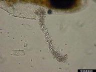 Spore-producing body ("pycnidia") oozing spores