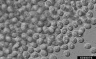 Spores of the fungus Phyllosticta ampelicida.
