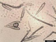 conidia