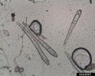 conidia