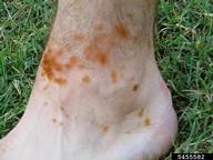 Staining and irritation of human skin