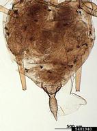 Female vivipara. Abdomen.