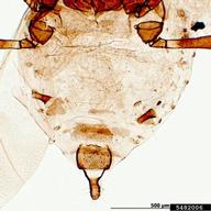 Female vivipara. Abdomen.
