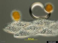 Peridial cells, surface view of two aeciospores, and air bubble