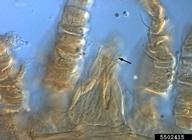 Gnathosoma with arrow indicating dorsal seta on palp femur. DIC.