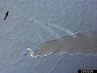 Leg I (arrow indicating dorsal seta on tibia). DIC.