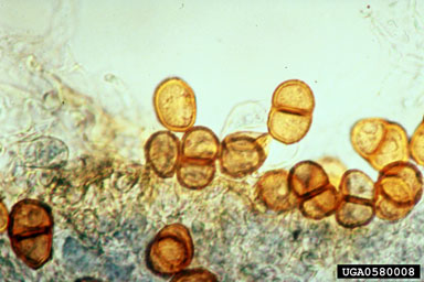 Figure 4. Urediniospores and teliospores of Puccinia carduorum. (Photograph by L.-T. Kok.)