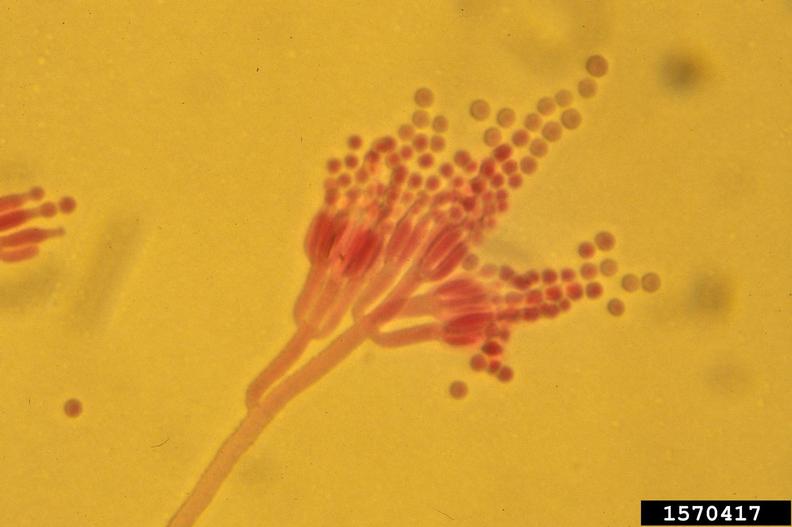 Penicillium fungus (Penicillium solitum)