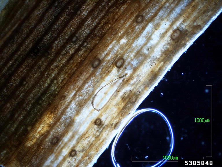 Dark-field observation of infected leaf tissue with many spore-producing bodies (