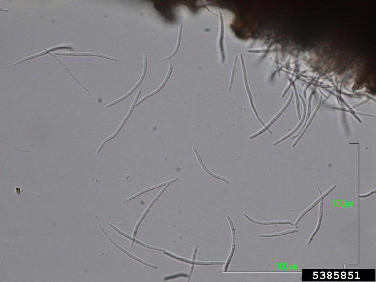 Asexual spores of the fungus Septoria tritici with a measurement scale